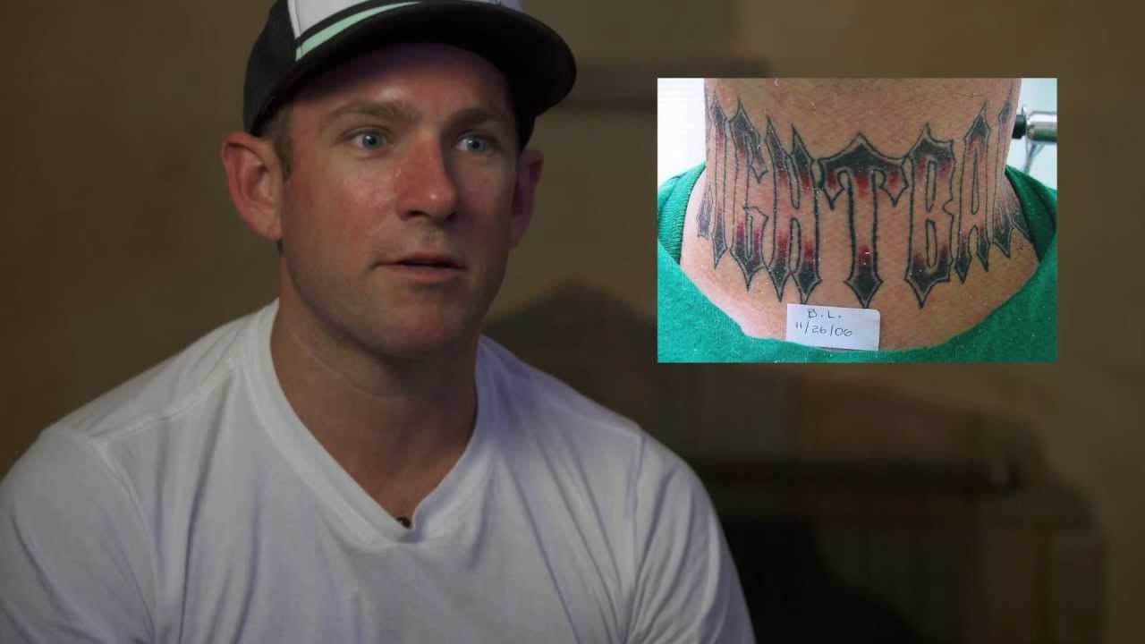 How Does Tattoo Removal Work? 