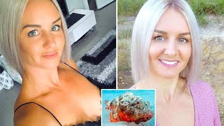 Top 10 Tiny Creatures That Can DESTROY You