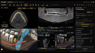 This Free Dental Viewer Segments a CBCT Scan with AI (In the Browser) screenshot 4