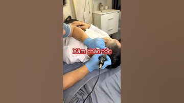 Xăm chân tóc che sẹo trên đầu mà không xâm lấn, an toàn cho da đầu! | Mỹ Rio Beauty Clinic #shorts