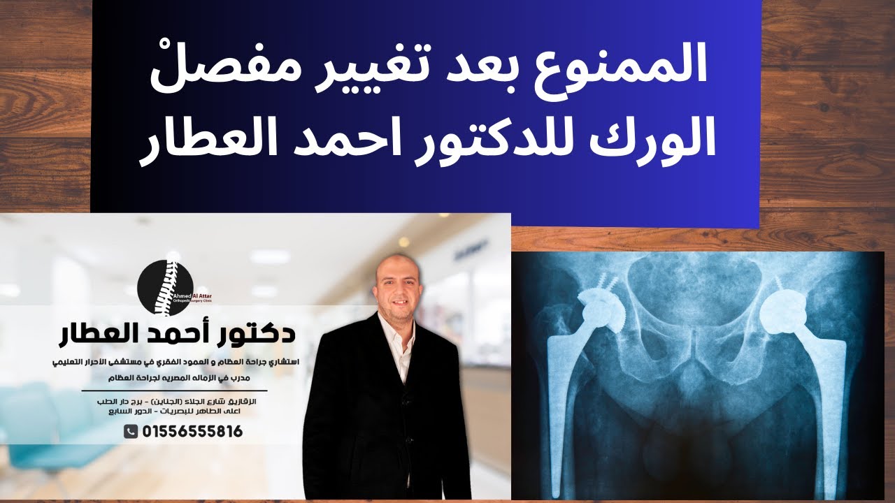 الممنوع بعد تغيير مفصلْ الورك