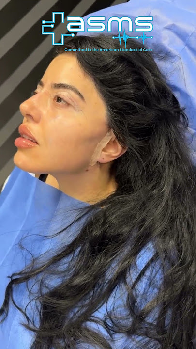 ✨ Laser Face Profiling – Precision Skin Reshaping ✨
