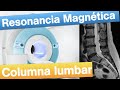 Resonancia magnética Lumbar - Cuándo y cómo se realiza.