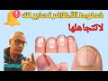 خطوط الأظافر تحذرك من مشاكل صحية محتملة
