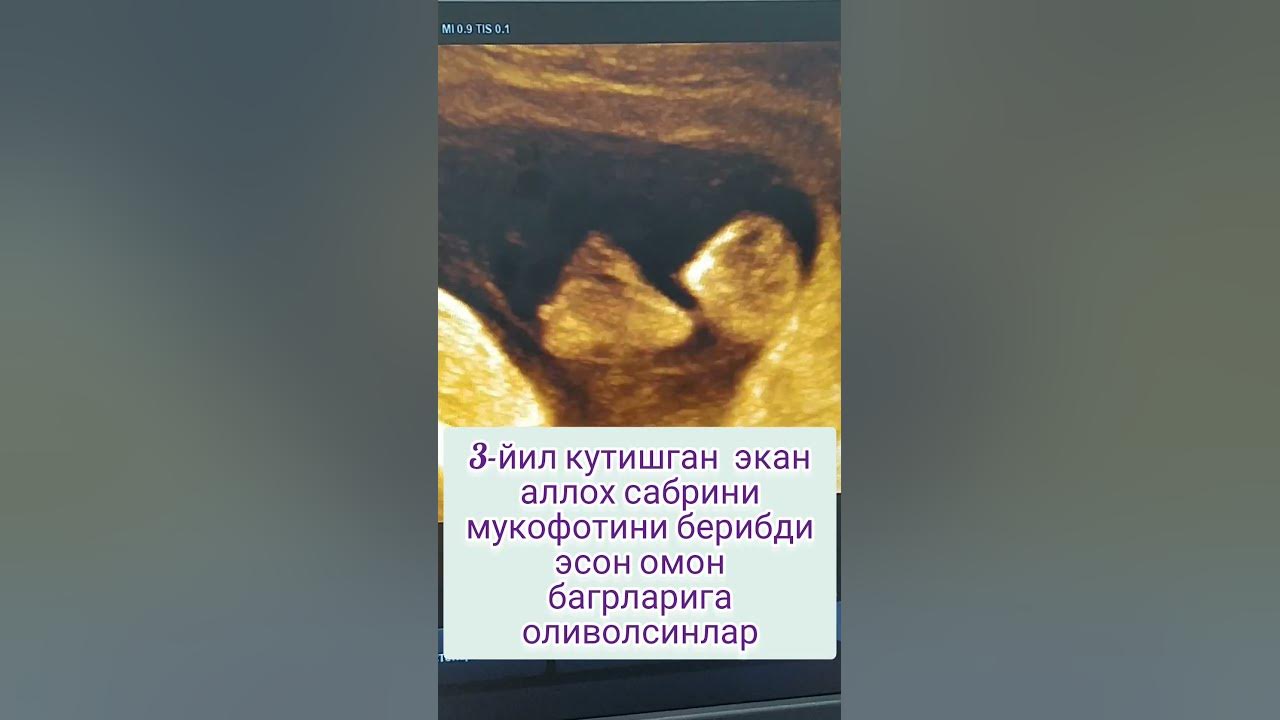 ширинтой - YouTube