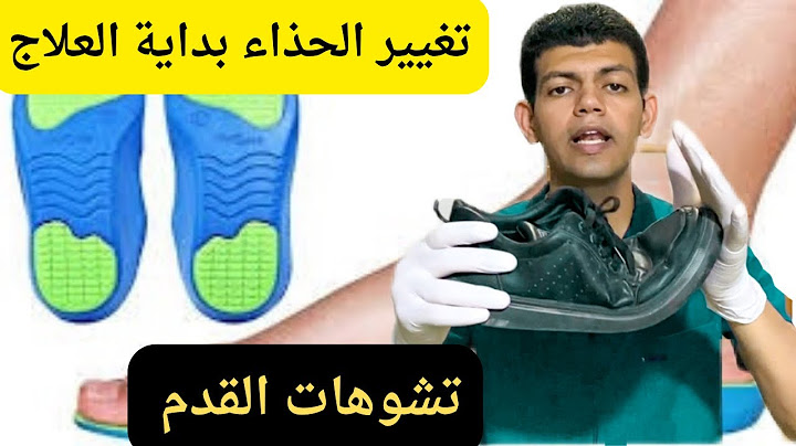 الحذاء المناسب للقدم/تشوهات القدم