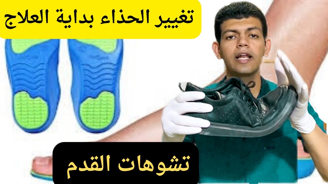 الحذاء المناسب للقدم/تشوهات القدم