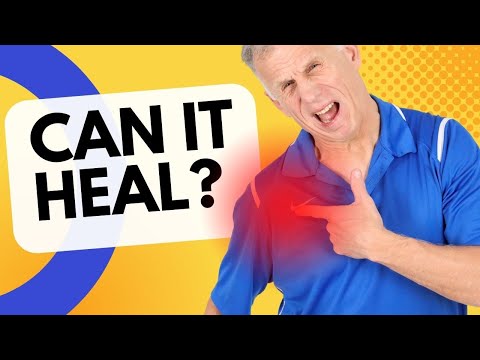 Video: 5 cách để chữa lành vết rách của Rotator Cuff