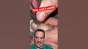 DOCTOR REACTS HOW TO NOT REMOVE AN INGROWN TOENAIL Shorts 