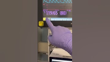 How to “Zero” the monitor when managing a patient with an arterial line.