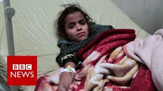 Yemen facing an 'unprecedented' outbreak of cholera - BBC News