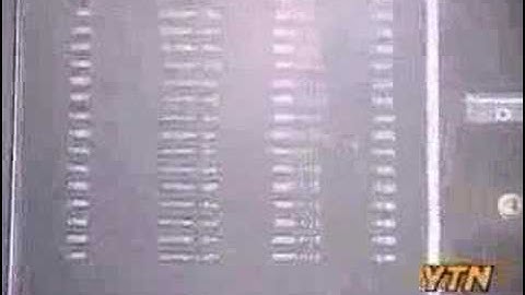 biometric - vein recognition