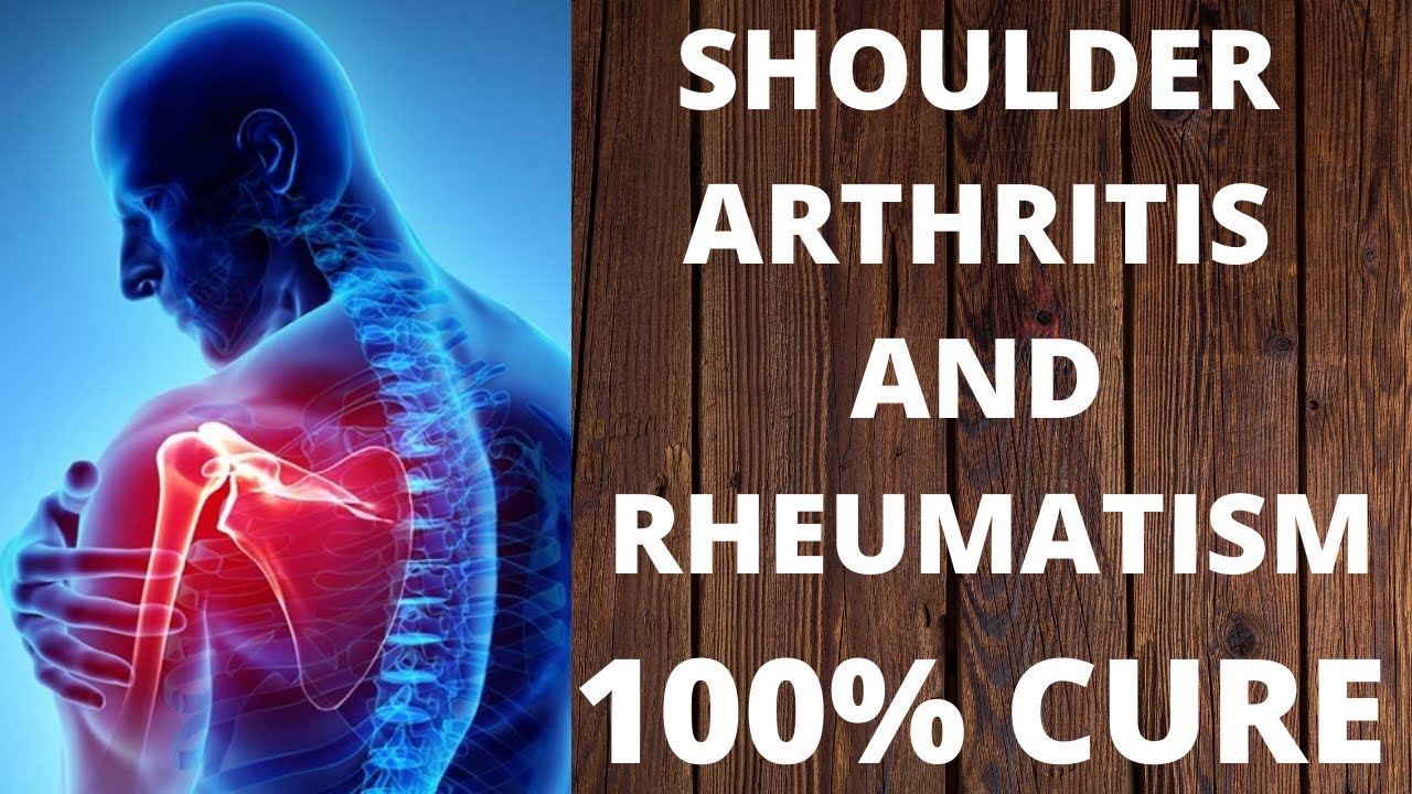 shoulder arthritis homeopathic medicine for shoulder joint pain in