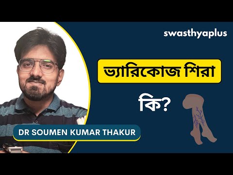 ভেরিকোজ ভেইন কি? | What are Varicose Veins? in Bangla | Dr Soumen Kumar Thakur