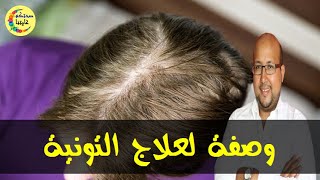 علاج التونية الثعلبة بمواد طبيعية  -  الدكتور عماد ميزاب  -