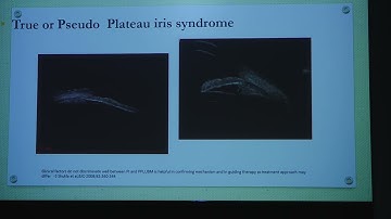 AIOC2022-IC250-ANTERIOR SEGMENT IMAGING: UNVEILING...Dr Mayuri B Khamar