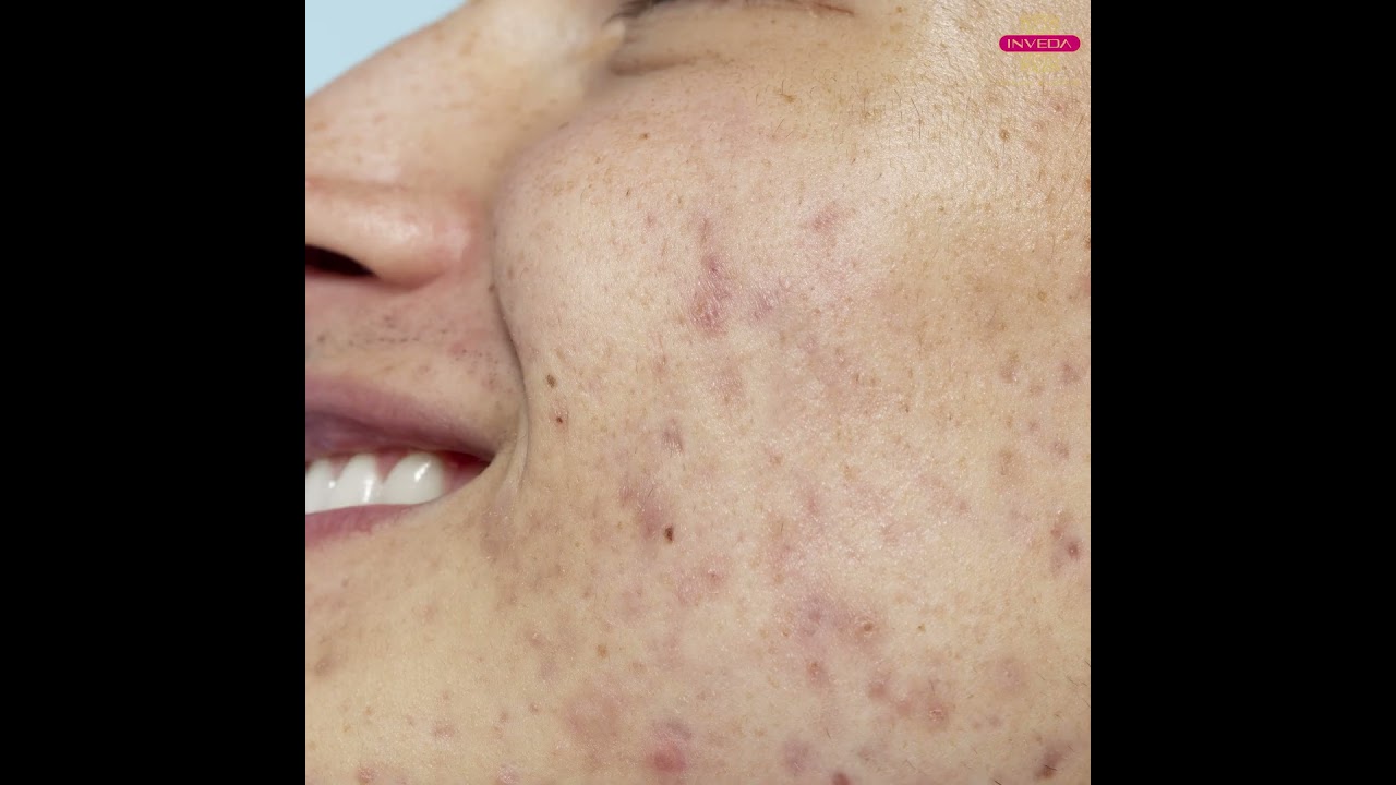 Want flawless✨😍 skin with just 1 Kit?🤔