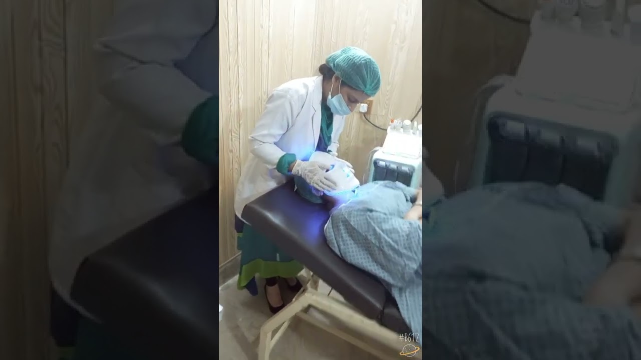 hydrafacial for acne prone skin