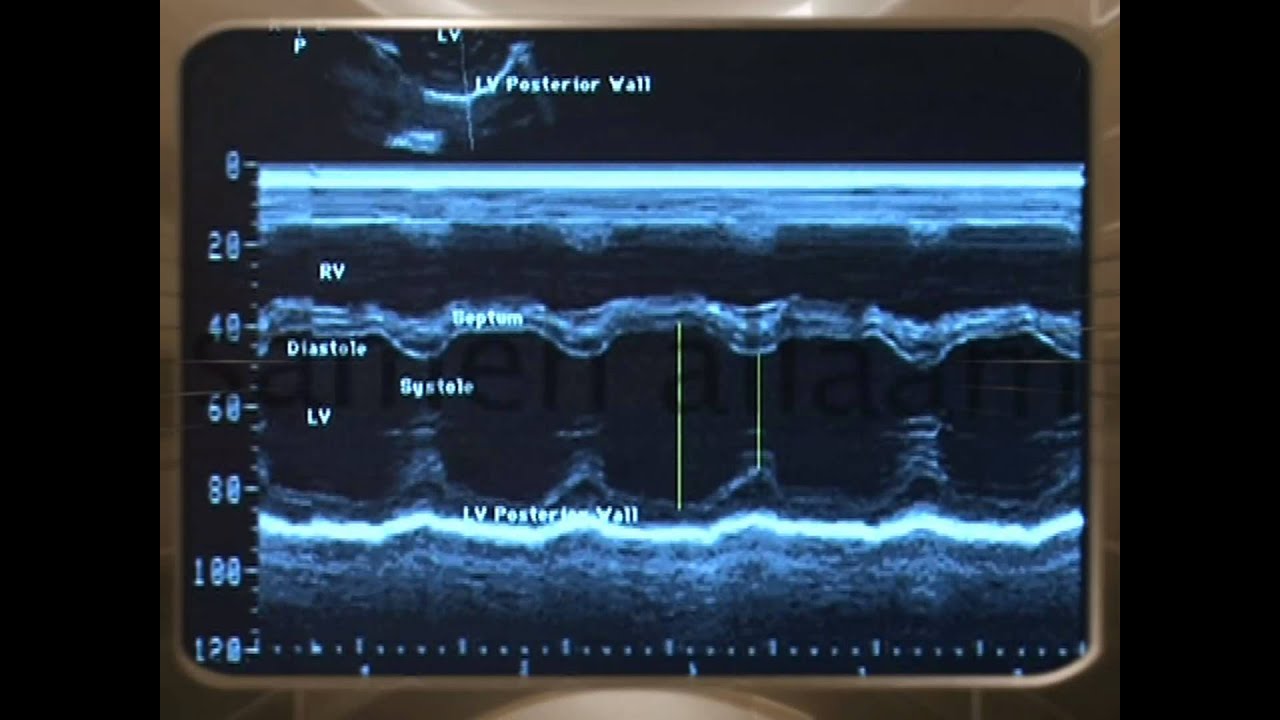 sameh allam principles of M_mode Echo