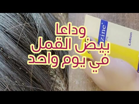 التخلص من حشرات الشعر القمل والسيبان بيض القمل خلال يوم واحد وتحدي كيفيه الوقايه من حشرات الشعر
