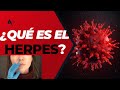 ¿Qué es el Herpes?