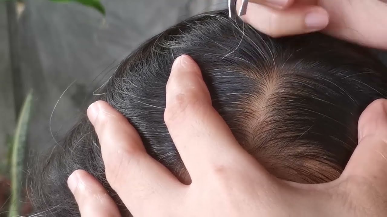 Plucking White Hair #4 | Super Satisfying #oddlysatisfying #supersatisfying #pluckingwhitehair