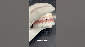 Dental Final Touch! #exocad #dental #smile