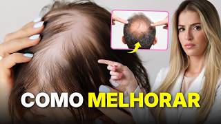 O que causa o CABELO RALO e SEM VIDA?