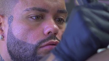 Scalp Micropigmentation Training