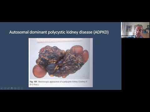 Pastest MRCP Part 1 Nephrology Webinar (hosted by Professor Phil Kalra)