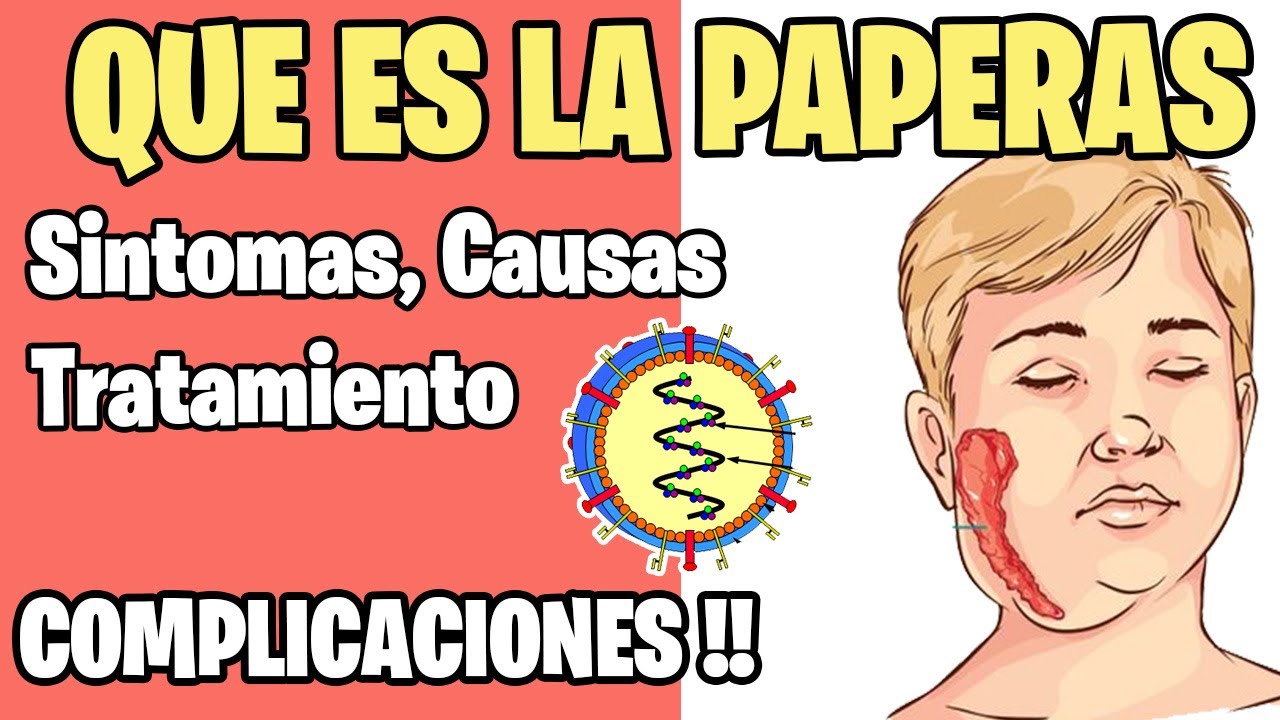 Que es la PAPERAS O PAROTIDITIS TEMA COMPLETO YouTube