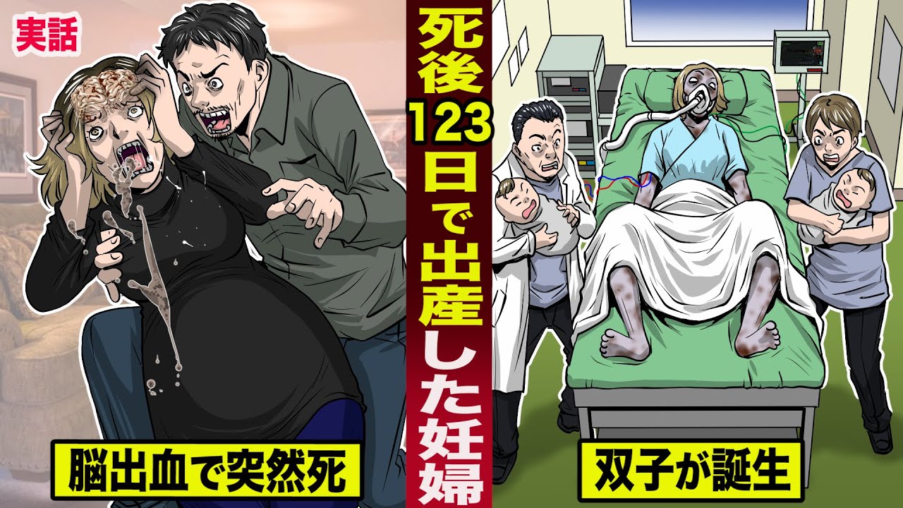 脳死 出産