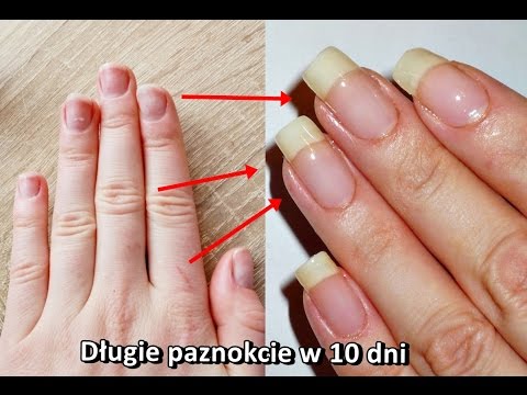 Alergia Lubic Rozne Jak Zapuscic Paznokcie W Tydzien Djembe Edu Pl