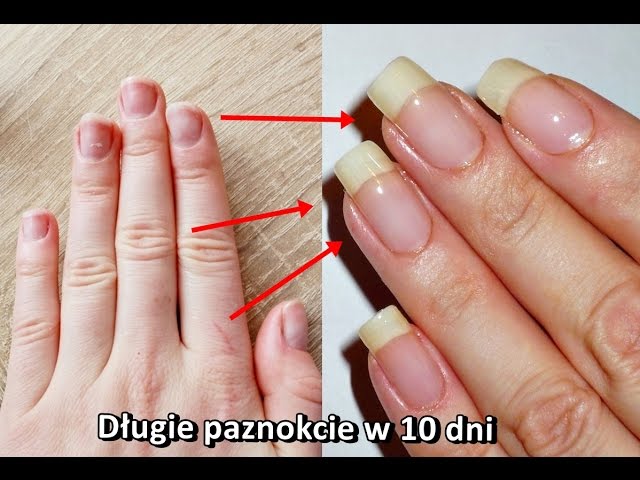 Jak Zapuscic Dlugie Paznokcie W 10 Dni Lepsza Metoda Diy Youtube