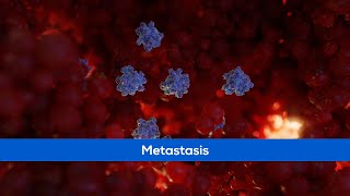 Medical Animation - Cancer Metastasis