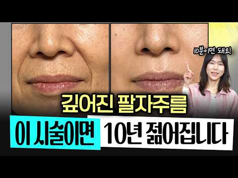 '팔자' '마리오네트' '이마' '목' 주름 😞 수술 없이 '내 살'로 채우는 기적의 시술 🩷 정한미 피부과전문의