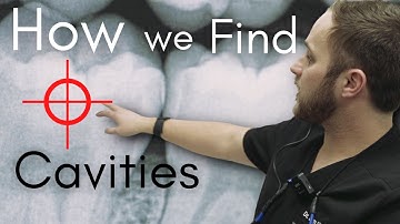 What a Cavity Looks Like