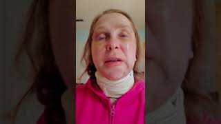 postoperative day 3 facelift,  neck lift,  fat transfers and submandibular gland resection