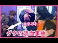 【BTSハプニング】ジョングクが手から流血！ステージ上のハプニング！