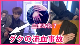 【BTSハプニング】ジョングクが手から流血！ステージ上のハプニング！