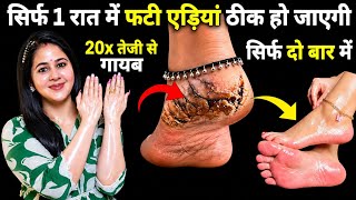 गारंटी है! 1 ही रात में ठीक हो जाएंगी फटी एड़ियांये जादुई उपाय एड़ी सॉफ्ट-मुलायम करेगा 😱 Cracked Heels