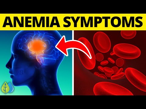 ❣️Top 12 Iron Deficiency Anemia Symptoms