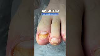 Ноготь изменил цвет или структуру? Не знаете, что делать?
