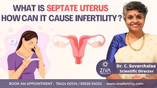 Septate Uterus And Fertility || Uterine Defects || Female Fertility || Dr C Suvarchalaa screenshot 3