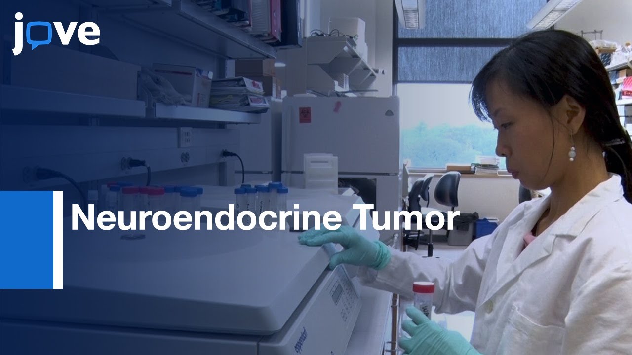 Small Bowel Neuroendocrine Tumor Spheroids Characterization | Protocol Preview