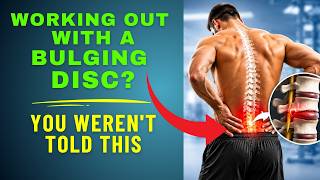 Can I Work Out With A Bulging Disc At L4-L5 or L5-S1 The WORST & BEST Advice