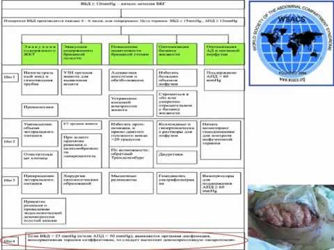 Внутрибрюшная гипертензия в нейрореанимации