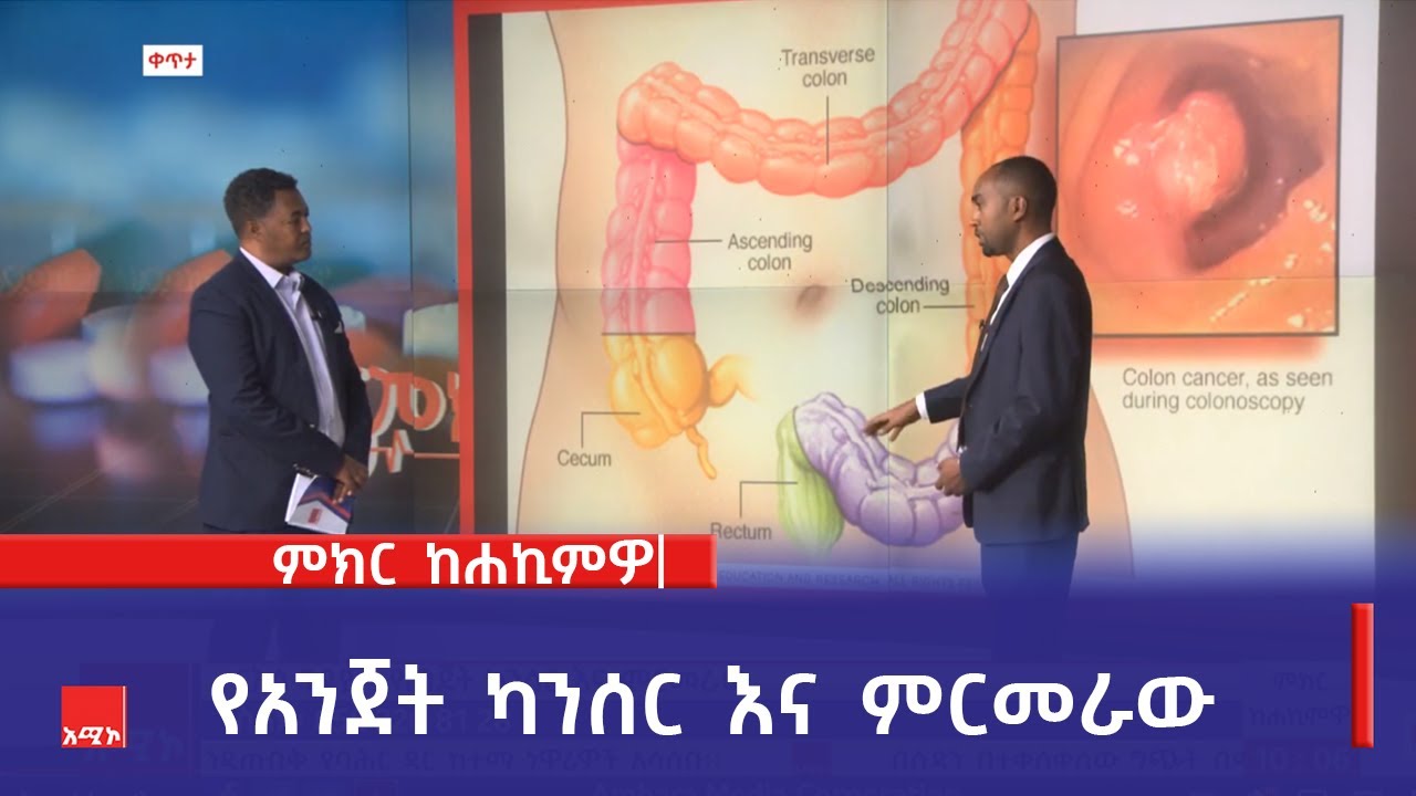 የአንጀት ካንሰር እና ምርመራው