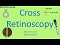 Cross Retinoscopy | Retinoscopy Procedure