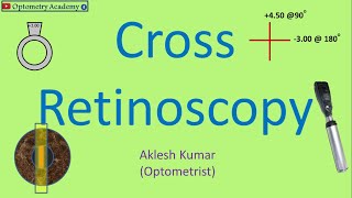 Cross Retinoscopy | Retinoscopy Procedure